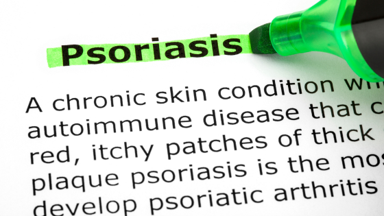 Psoriasis